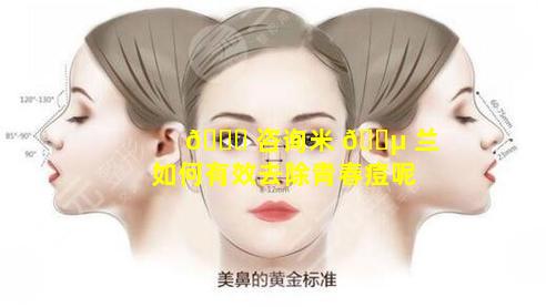 🐅 咨询米 🐵 兰如何有效去除青春痘呢